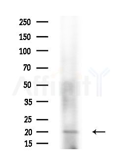 Phospho-Claudin 1 (Tyr210) Antibody - Western blot analysis of lysates from Mouse testis, using Phospho-Claudin 1 (Tyr210) Antibody at 1/1000 dilution.