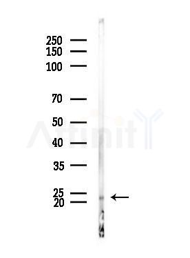 Phospho-Claudin 1 (Tyr210) Antibody - Western blot analysis of lysates from Mouse testis, using Phospho-Claudin 1 (Tyr210) Antibody at 1/1000 dilution.