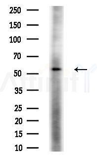 Phospho-CRMP-1 (Tyr504) Antibody - Western blot analysis of extracts from A375 cells(heat-shock,45min treatment), using Phospho-CRMP-1 (Tyr504) Antibody at 1/1000 dilution.