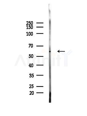 Phospho-CRMP-1 (Tyr504) Antibody - Western blot analysis of lysates from A375 cells(heat-shock,45min treatment), using Phospho-CRMP-1 (Tyr504) Antibody at 1/1000 dilution.