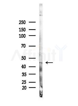 Phospho-CtBP1/2 (Ser158/Ser164) Antibody - Western blot analysis of lysates from PC12 cells(LPS, 4h treatment), using Phospho-CtBP1/2 (Ser158/Ser164) Antibody at 1/1000 dilution.