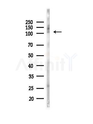 Phospho-CTNND1 (Tyr257) Antibody - Western blot analysis of lysates from PC12 cells(heat-shock,45min treatment), using Phospho-CTNND1 (Tyr257) Antibody at 1/1000 dilution.