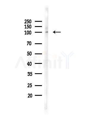 Phospho-CTNND1 (Tyr904) Antibody - Western blot analysis of lysates from PC12 cells(heat-shock,45min treatment), using Phospho-CTNND1 (Tyr904) Antibody at 1/1000 dilution.