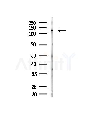 Phospho-CUTL1 (Ser1215) Antibody - Western blot analysis of lysates from HUVEC cells(starvation,24h treatment), using Phospho-CUTL1 (Ser1215) Antibody at 1/1000 dilution.