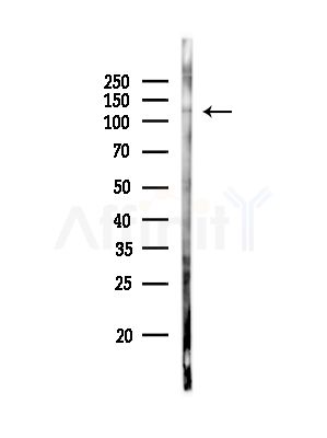Phospho-CUTL1 (Ser1215) Antibody - Western blot analysis of lysates from Rat liver, using Phospho-CUTL1 (Ser1215) Antibody at 1/1000 dilution.