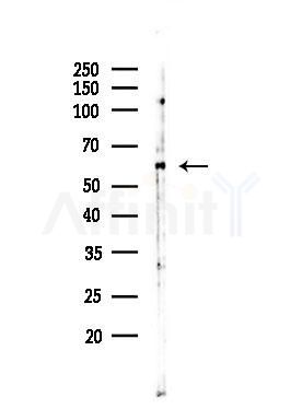 Phospho-Cyclin B1 (Ser128) Antibody - Western blot analysis of lysates from COLO205 cells(heat-shock,45min treatment), using Phospho-Cyclin B1 (Ser128) Antibody at 1/1000 dilution.