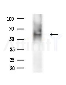 Phospho-Cyclin B1 (Ser133) Antibody - Western blot analysis of extracts from 293 cells(starvation treatment), using Phospho-Cyclin B1 (Ser133) Antibody at 1/1000 dilution.