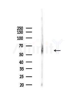 Phospho-Cyclin B1 (Ser133) Antibody - Western blot analysis of lysates from 293 cells(starvation,24h treatment), using Phospho-Cyclin B1 (Ser133) Antibody at 1/1000 dilution.