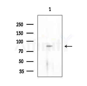 Phospho-eEF2K (Ser359) Antibody - Western blot analysis of extracts from Mouse testis, using Phospho-eEF2K (Ser359) Antibody at 1/1000 dilution.