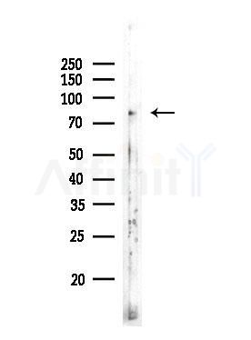 Phospho-eEF2K (Ser359) Antibody - Western blot analysis of lysates from Mouse testis, using Phospho-eEF2K (Ser359) Antibody at 1/1000 dilution.