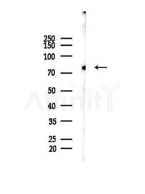 Phospho-FOXO1A (Ser249) Antibody - Western blot analysis of lysates from MCF7 cells(heat-shock,45min treatment), using Phospho-FOXO1A (Ser249) Antibody at 1/1000 dilution.