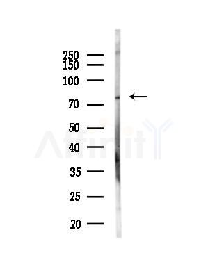 Phospho-FOXO1A (Ser249) Antibody - Western blot analysis of lysates from Rat liver, using Phospho-FOXO1A (Ser249) Antibody at 1/1000 dilution.