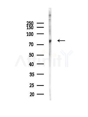 Phospho-FOXO1A (Ser249) Antibody - Western blot analysis of lysates from A375 cells(heat-shock,45min treatment), using Phospho-FOXO1A (Ser249) Antibody at 1/1000 dilution.