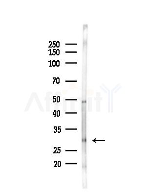 Phospho-NACA (Thr159) Antibody - Western blot analysis of lysates from LoVo cells(heat-shock,45min treatment), using Phospho-NACA (Thr159) Antibody at 1/1000 dilution.