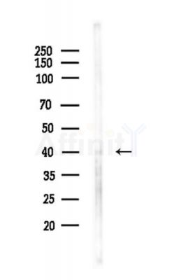 Phospho-NDRG2 (Thr348) Antibody - Western blot analysis of lysates from LoVo cells(heat-shock,45min treatment), using Phospho-NDRG2 (Thr348) Antibody at 1/1000 dilution.