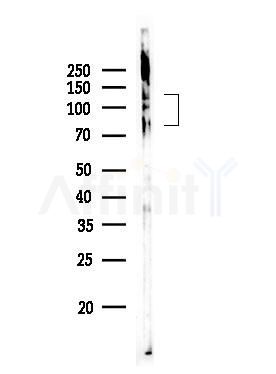 Phospho-NFAT2 (Ser172) Antibody - Western blot analysis of lysates from EC304 cells, using Phospho-NFAT2 (Ser172) Antibody at 1/1000 dilution.