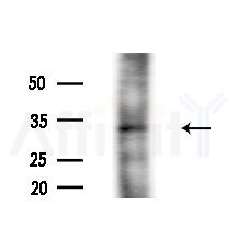Phospho-PDX1 (Ser66) Antibody - Western blot analysis of lysates from PC12 cells, using Phospho-PDX1 (Ser66) Antibody at 1/1000 dilution.