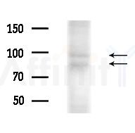 Phospho-Progesterone Receptor (Ser345) Antibody - Western blot analysis of extracts from A375 cells(heat-shock,45min treatment), using Phospho-Progesterone Receptor (Ser345) Antibody at 1/1000 dilution.