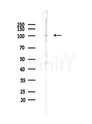 Phospho-Progesterone Receptor (Ser345) Antibody - Western blot analysis of lysates from Mouse brain, using Phospho-Progesterone Receptor (Ser345) Antibody at 1/1000 dilution.