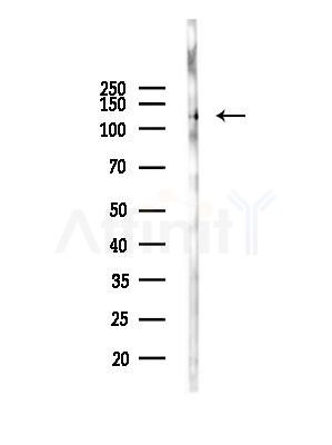 Phospho-Progesterone Receptor (Ser345) Antibody - Western blot analysis of lysates from Mouse brain, using Phospho-Progesterone Receptor (Ser345) Antibody at 1/1000 dilution.