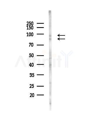 Phospho-Progesterone Receptor (Ser345) Antibody - Western blot analysis of lysates from A375 cells(heat-shock,45min treatment), using Phospho-Progesterone Receptor (Ser345) Antibody at 1/1000 dilution.