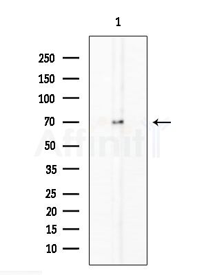 Phospho-Presenilin 1 (Ser353) Antibody - Western blot analysis of extracts from Rat testis, using Phospho-Presenilin 1 (Ser353) Antibody at 1/1000 dilution.