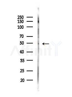 Phospho-PTP1B (Tyr66) Antibody - Western blot analysis of lysates from PC12 cells(LPS, 4h treatment), using Phospho-PTP1B (Tyr66) Antibody at 1/1000 dilution.