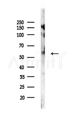 Phospho-Smad1/5/9 (Ser463+Ser465) Antibody - Western blot analysis of lysates from Hela cells(heat-shock,45min treatment), using Phospho-Smad1/5/9 (Ser463+Ser465) Antibody at 1/1000 dilution.