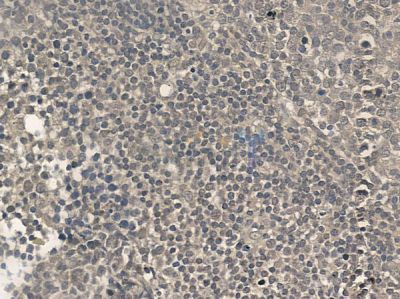 Phospho-Smad4 (Thr276)[Thr277] Antibody - AF8316 at 1/100 staining human normal lung tissue by IHC-P.