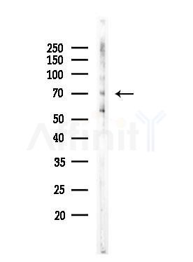 Phospho-Smad4 (Thr276)[Thr277] Antibody - Western blot analysis of lysates from COLO205 cells(heat-shock,45min treatment), using Phospho-Smad4 (Thr276)[Thr277] Antibody at 1/1000 dilution.