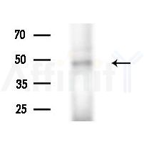 Phospho-ETV6 / Tel (Ser257) Antibody - Western blot analysis of lysates from 293 cells(starvation treatment), using Phospho-ETV6 / Tel (Ser257) Antibody at 1/1000 dilution.