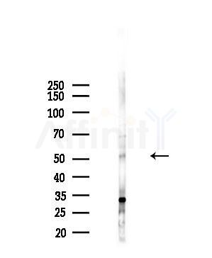 Phospho-ETV6 / Tel (Ser257) Antibody - Western blot analysis of lysates from 293 cells(starvation,24h treatment), using Phospho-ETV6 / Tel (Ser257) Antibody at 1/1000 dilution.