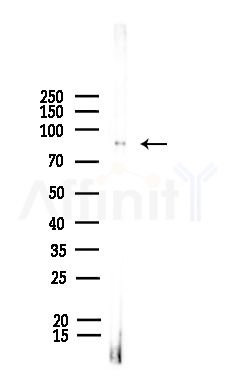 Phospho-beta Catenin (Ser552) Antibody - Western blot analysis of lysates from Rat liver, using Phospho-beta Catenin (Ser552) Antibody at 1/1000 dilution.