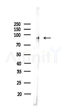 Phospho-beta Catenin (Ser552) Antibody - Western blot analysis of lysates from Mouse lung, using Phospho-beta Catenin (Ser552) Antibody at 1/1000 dilution.