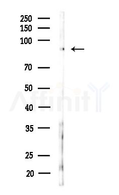 Phospho-beta Catenin (Ser552) Antibody - Western blot analysis of lysates from B16F10-LUC cells(starvation,24h treatment), using Phospho-beta Catenin (Ser552) Antibody at 1/1000 dilution.