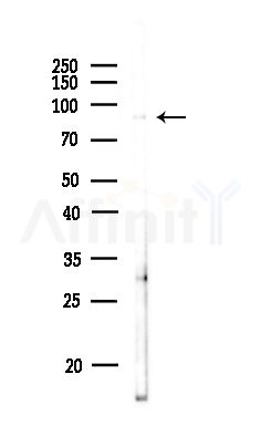 Phospho-beta Catenin (Ser552) Antibody - Western blot analysis of lysates from MDA-MB-231 cells(heat-shock,45min treatment), using Phospho-beta Catenin (Ser552) Antibody at 1/1000 dilution.