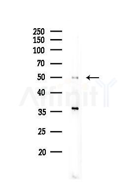 Phospho-Cyclin E1 (Ser399) Antibody - Western blot analysis of lysates from COLO205 cells(heat-shock,45min treatment), using Phospho-Cyclin E1 (Ser399) Antibody at 1/1000 dilution.