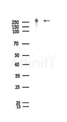 Phospho-POLR2A (Ser1616/Ser2) Antibody - Western blot analysis of lysates from Rat spleen, using Phospho-POLR2A (Ser1616/Ser2) Antibody at 1/1000 dilution.