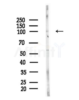 Phospho-PRK1/2 (Thr774/Thr816) Antibody - Western blot analysis of lysates from COLO205 cells(heat-shock,45min treatment), using Phospho-PRK1/2 (Thr774/Thr816) Antibody at 1/1000 dilution.