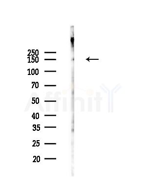 Phospho-Raptor (Ser792) Antibody - Western blot analysis of lysates from COLO205 cells(heat-shock,45min treatment), using Phospho-Raptor (Ser792) Antibody at 1/1000 dilution.