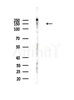Phospho-Raptor (Ser792) Antibody - Western blot analysis of lysates from Hela cells(LPS, 4h treatment), using Phospho-Raptor (Ser792) Antibody at 1/1000 dilution.