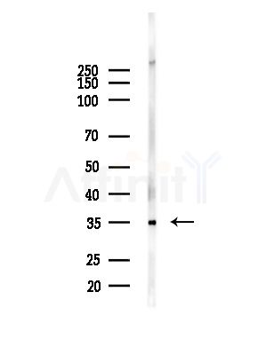 Phospho-TNNI3 (Ser23+Ser24) Antibody - Western blot analysis of lysates from Mouse brain, using Phospho-TNNI3 (Ser23+Ser24) Antibody at 1/1000 dilution.