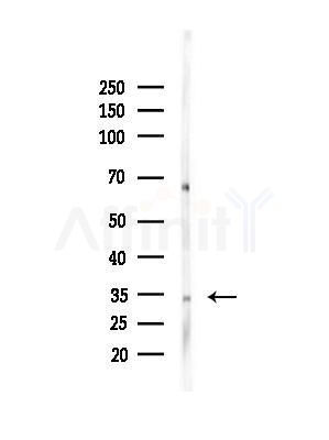 Phospho-Caspase 3 (Ser26) Antibody - Western blot analysis of lysates from Hela cells(heat-shock,45min treatment), using Phospho-Caspase 3 (Ser26) Antibody at 1/1000 dilution.