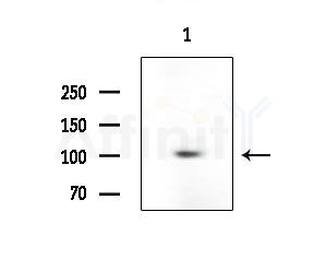 Phospho-E-cadherin (Ser844) Antibody - Western blot analysis of lysates from Hela cells, using Phospho-E-cadherin (Ser844) Antibody at 1/1000 dilution.