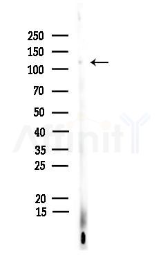 Phospho-E-cadherin (Ser844) Antibody - Western blot analysis of lysates from Hela cells, using Phospho-E-cadherin (Ser844) Antibody at 1/1000 dilution.