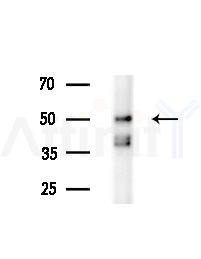 Phospho-DOK2 (Tyr139) Antibody - Western blot analysis of extracts from Mouse brain, using Phospho-DOK2 (Tyr139) Antibody at 1/1000 dilution.