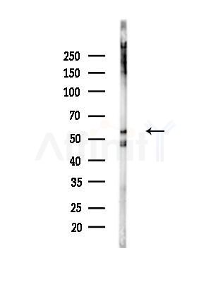 Phospho-DOK2 (Tyr139) Antibody - Western blot analysis of lysates from Mouse brain, using Phospho-DOK2 (Tyr139) Antibody at 1/1000 dilution.