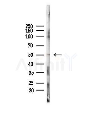 Phospho-ETS1 (Ser251) Antibody - Western blot analysis of lysates from HUVEC cells, using Phospho-ETS1 (Ser251) Antibody at 1/1000 dilution.