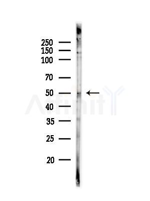 Phospho-ETS1 (Ser251) Antibody - Western blot analysis of lysates from EC304 cells, using Phospho-ETS1 (Ser251) Antibody at 1/1000 dilution.