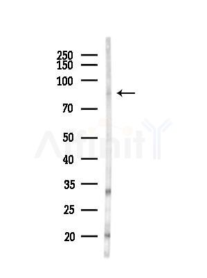 Phospho-GRK1/2 (Tyr13) Antibody - Western blot analysis of lysates from LoVo cells(heat-shock,45min treatment), using Phospho-GRK1/2 (Tyr13) Antibody at 1/1000 dilution.